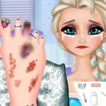 Elsa Foot Injured